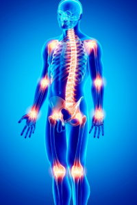 Criterios de diagnóstico de la fibromialgia
